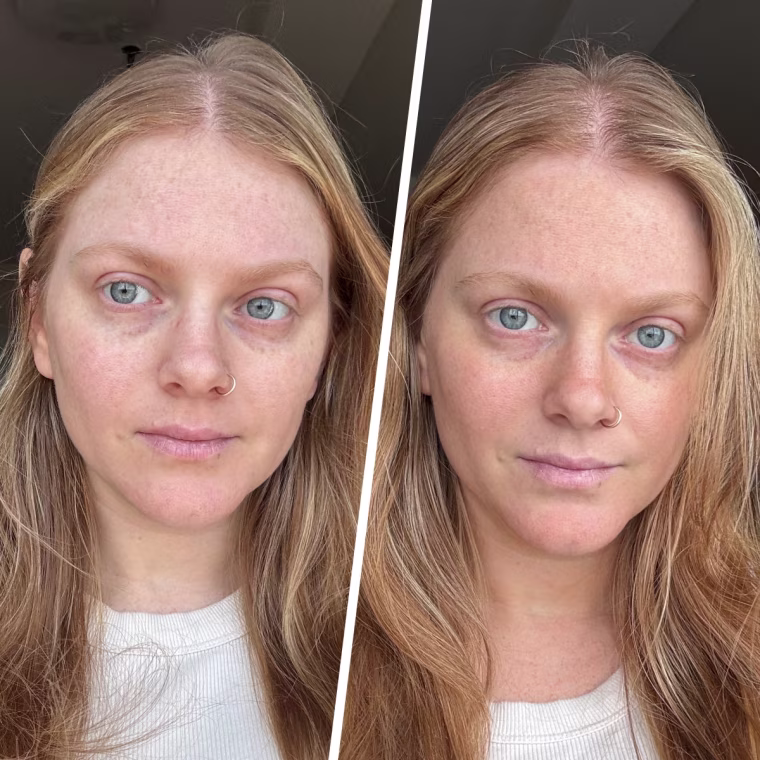 Photo editor Kara Birnbaum before and after using the Dr. Dennis Gross Alpha Beta Glow Pad Self-Tanner.