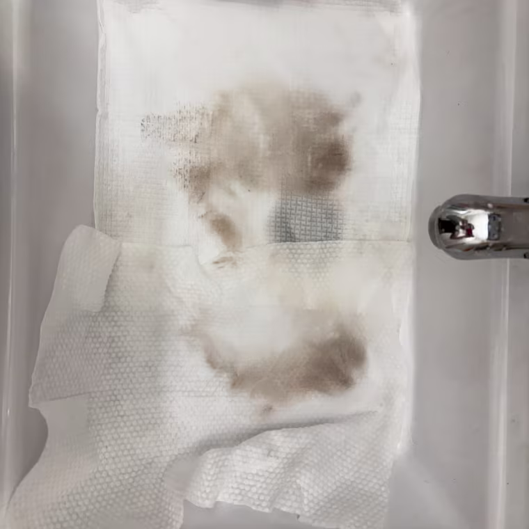 A Grace & Stella disposable towel (top) compared to an Ourmed disposable towel (bottom) after cleaning my face.