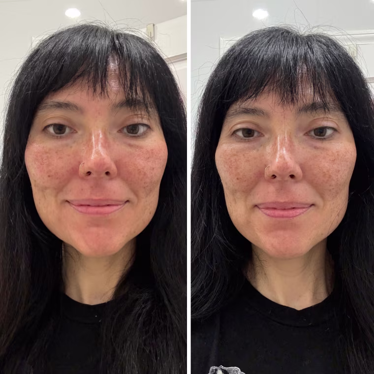 Tester Melissa Matthews before (left) and after (right) applying the Dr. Idriss Left Un-Red CalmBack Cream