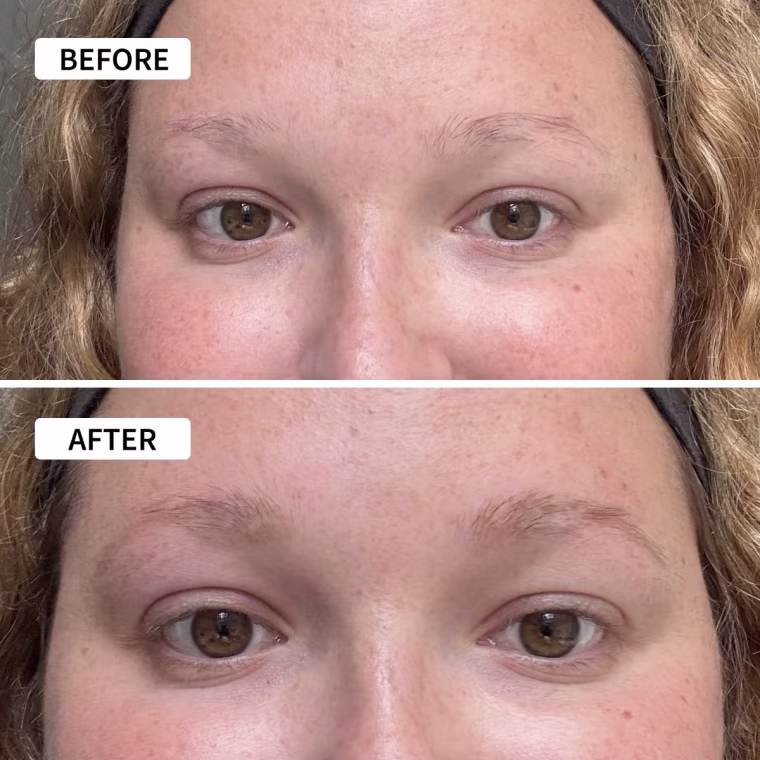 Before and after using the Subtl 3-in-1 Brow BFF.