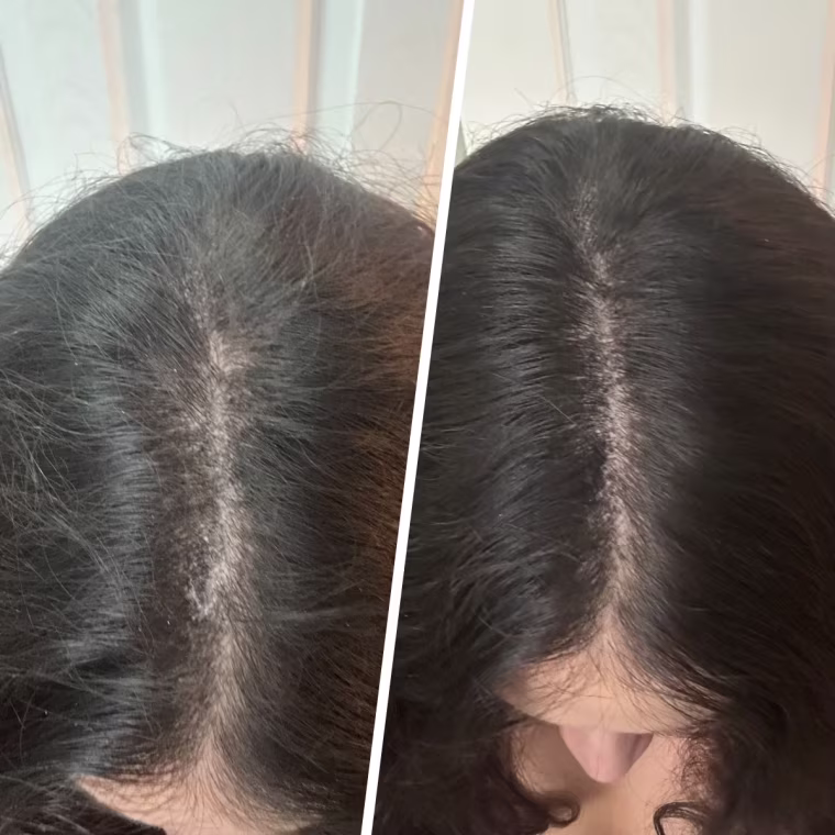 Before (left) and after (right)