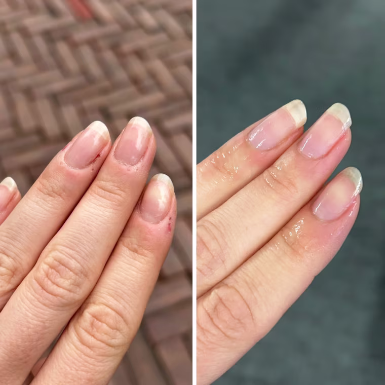 Before and after using the Londontown Peptide Serum Concentrate.