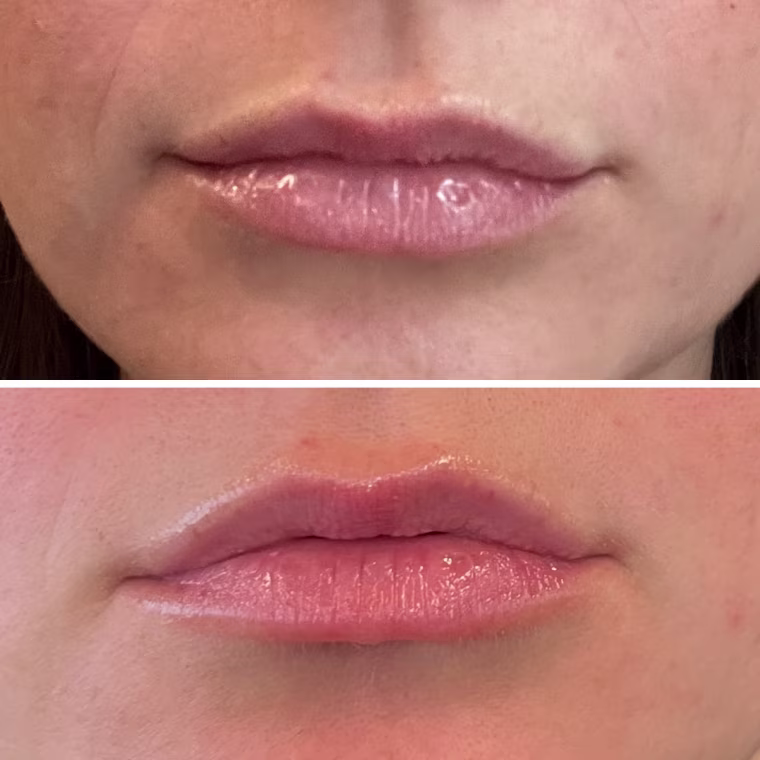 Kiehl's Ultra Meltdown Medicated Lip Gel before (top) and after (bottom) use.