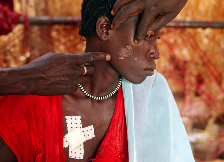 A Nuba woman, injured during a raid by Sudan's air force, sits in a makeshift hospital in the Nuba Mountains, South Kordofan.