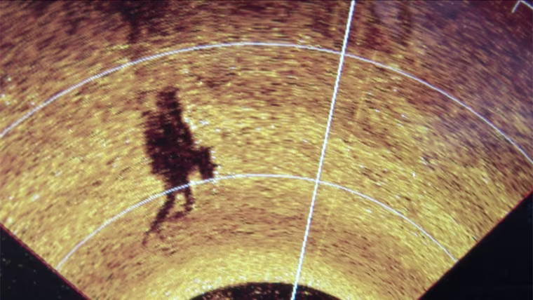 Sonar image of diver