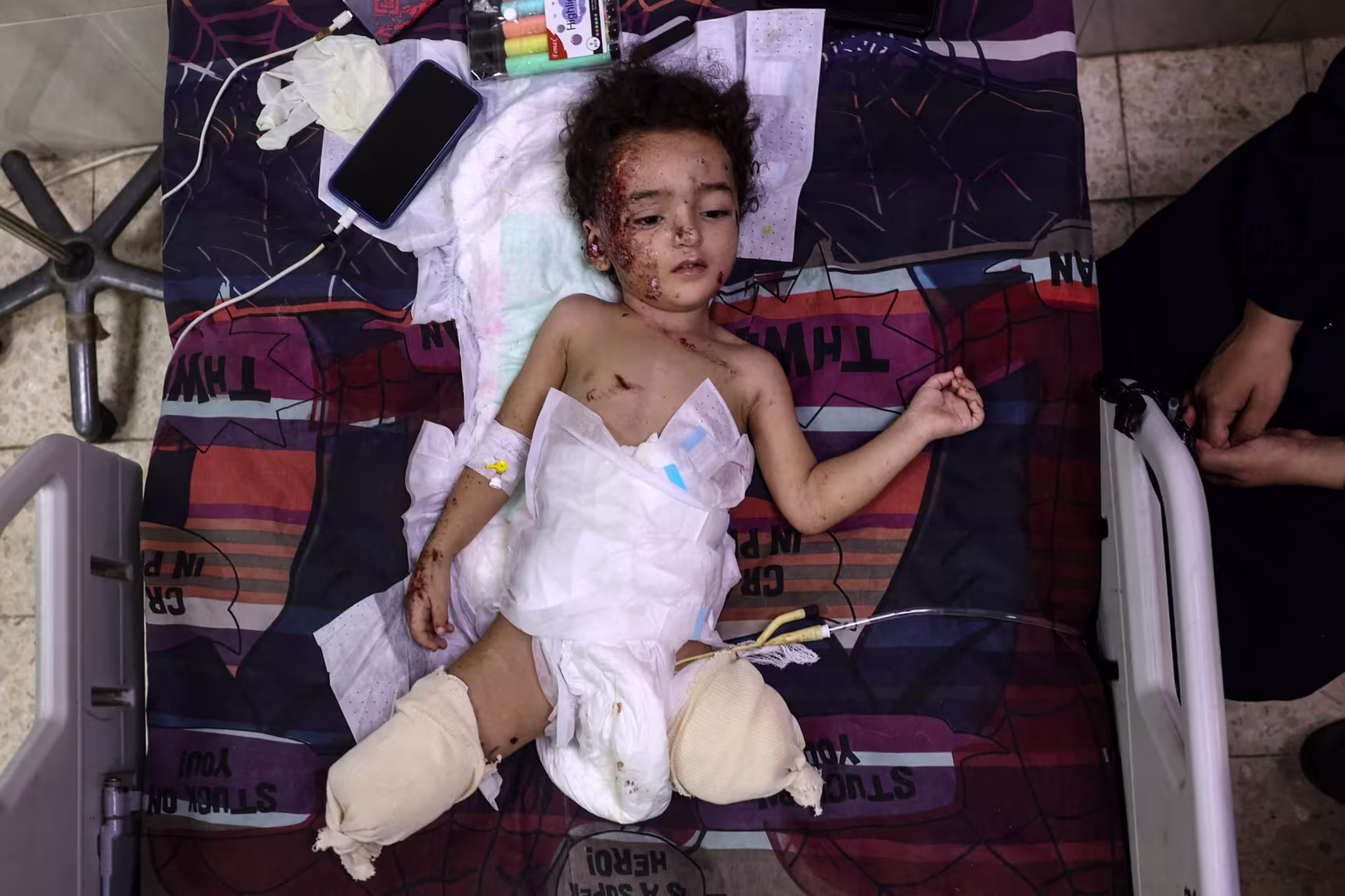 A young Palestinian girl at the Al-Aqsa Martyrs hospital in Deir el-Balah, central Gaza, on Sept. 8.