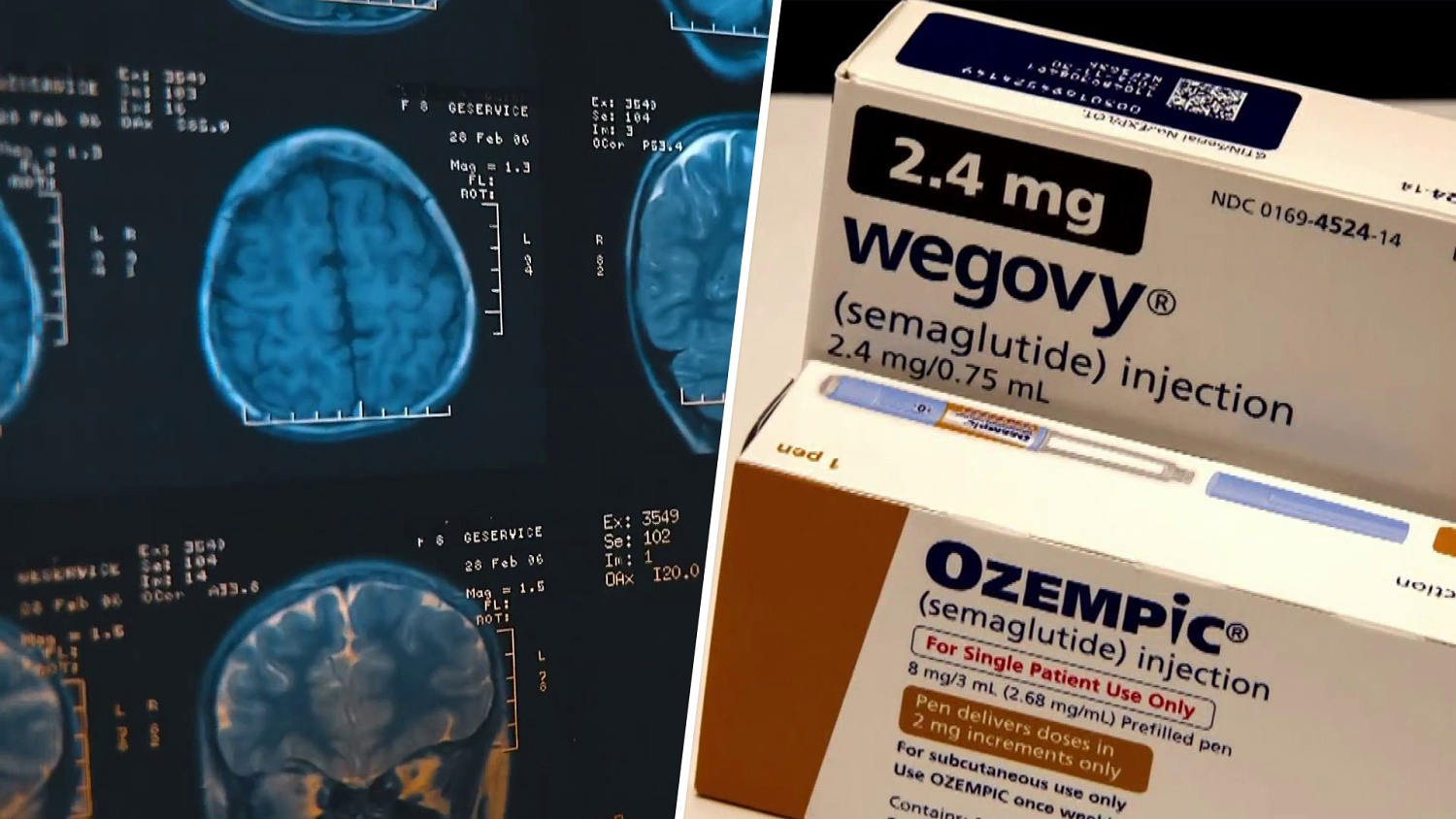 semaglutide dementia Study Shows Some Weight Loss Drugs May Stave Off Dementia