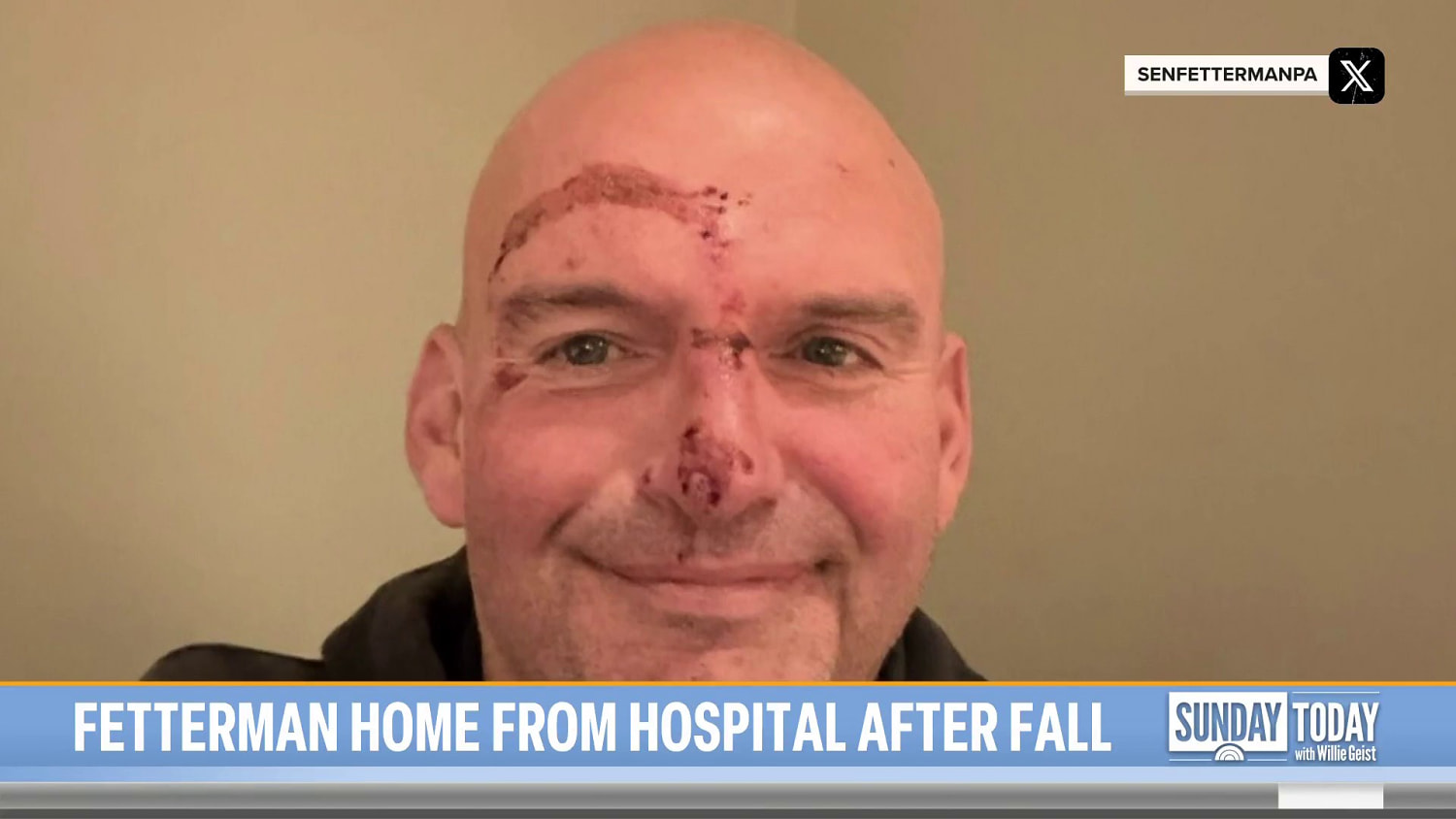 Sen. John Fetterman Back Home From Hospital After Fall