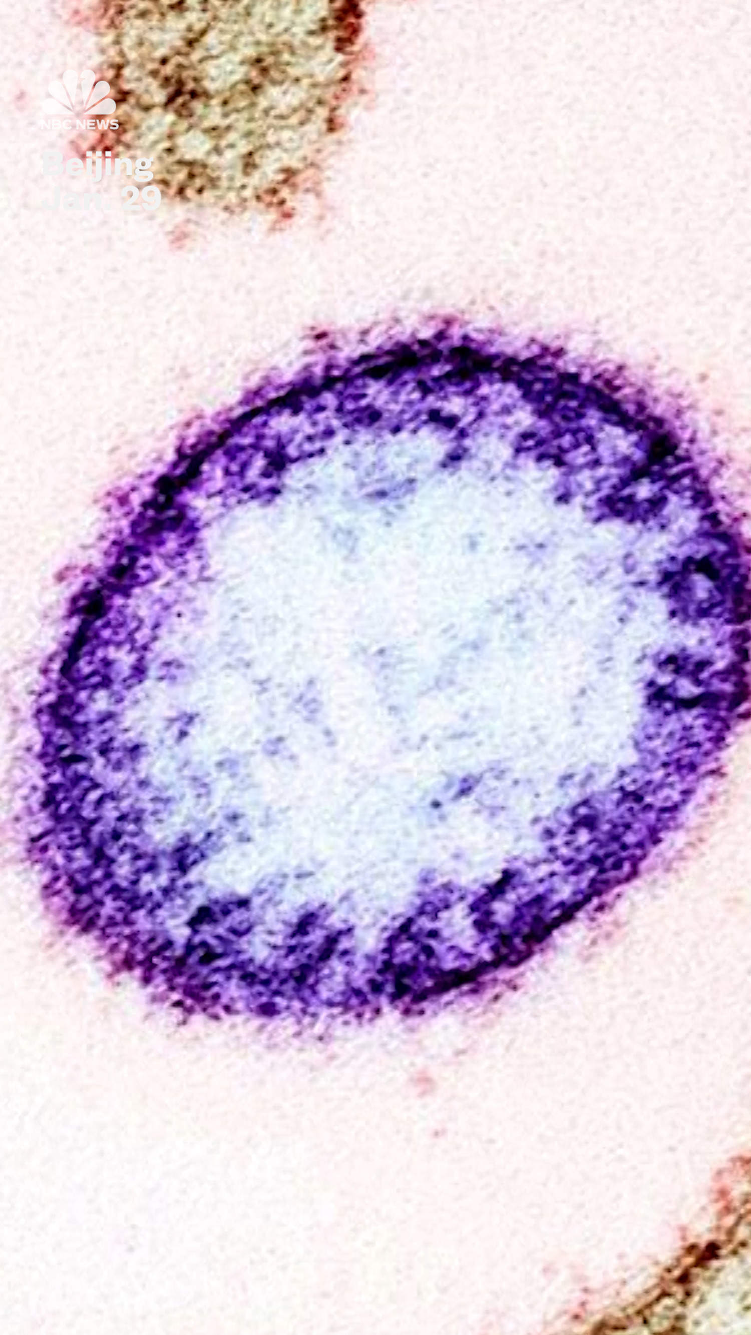 India says it has contained Nipah virus outbreak