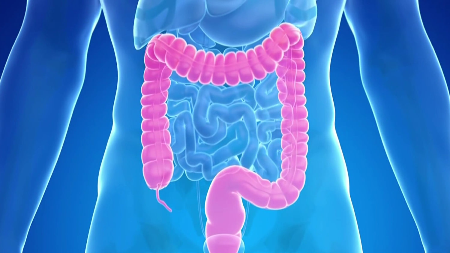 New blood test is added an an option for colorectal cancer screenings