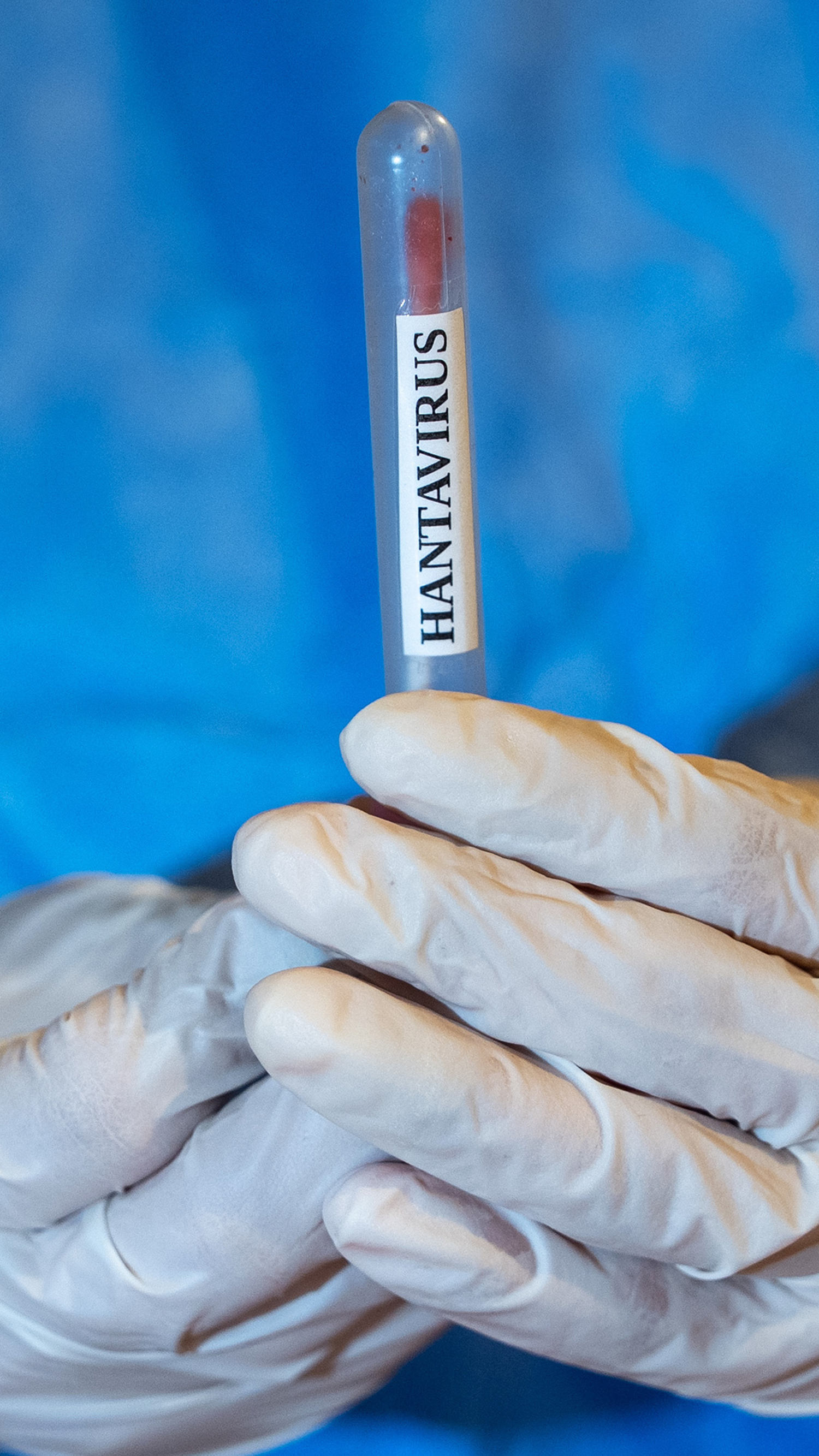 Officials track hantavirus as passengers return to U.S.