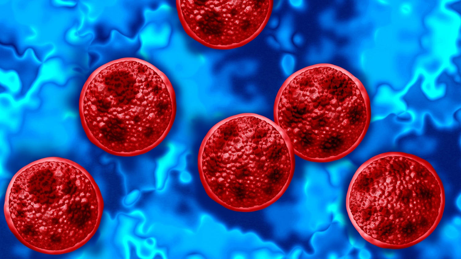 Michigan reports two deaths linked to cyclosporiasis outbreak