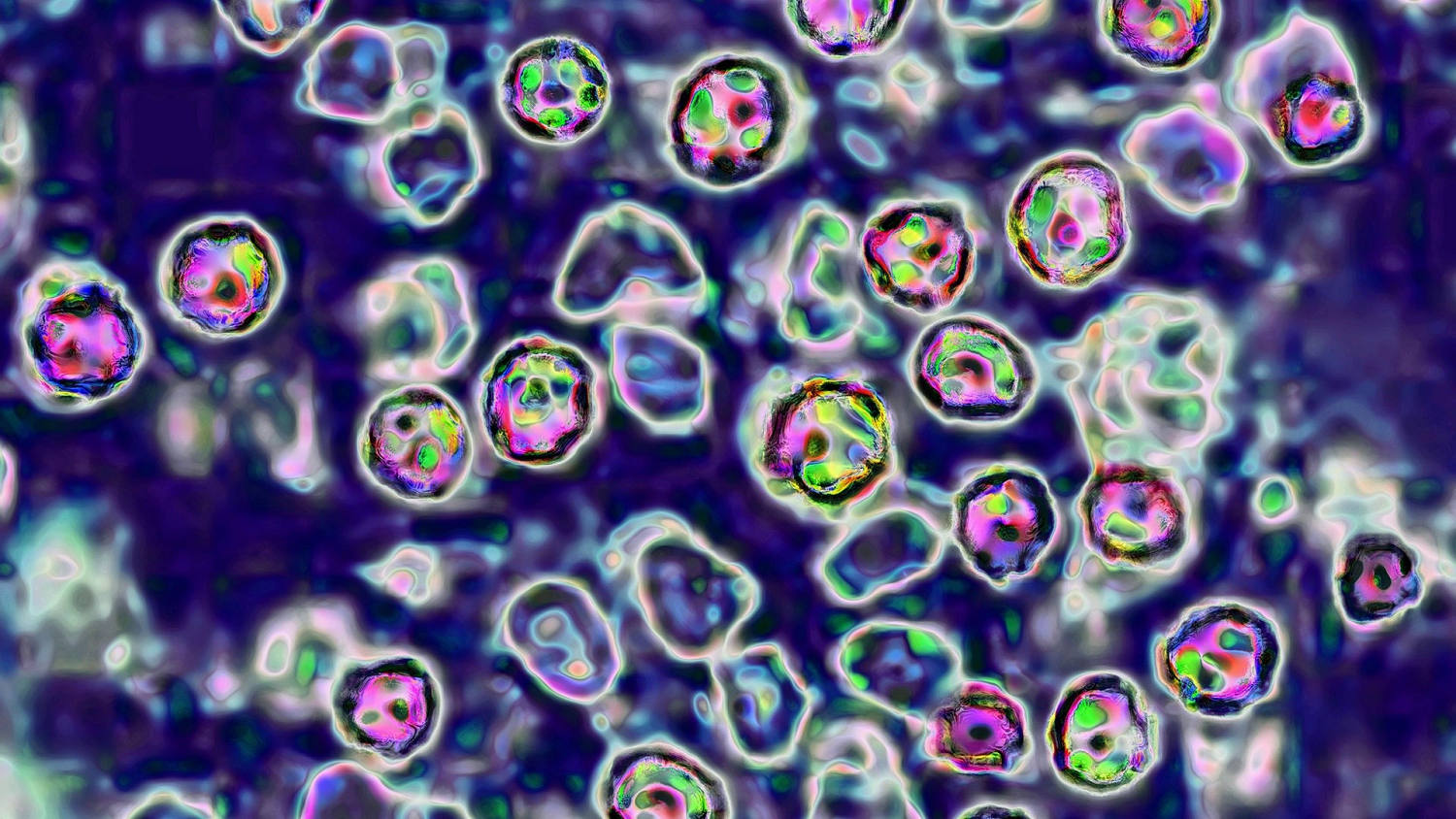 Health Officials Report 2 Measles-Related Deaths in Pennsylvania​Health Officials Report 2 Measles-Related Deaths in Pennsylvania 