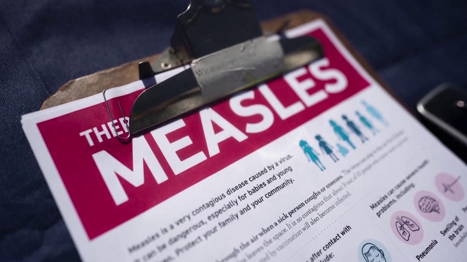 NY Declares Measles Emergency; Pennsylvania Cases Surge​NY Declares Measles Emergency; Pennsylvania Cases Surge 