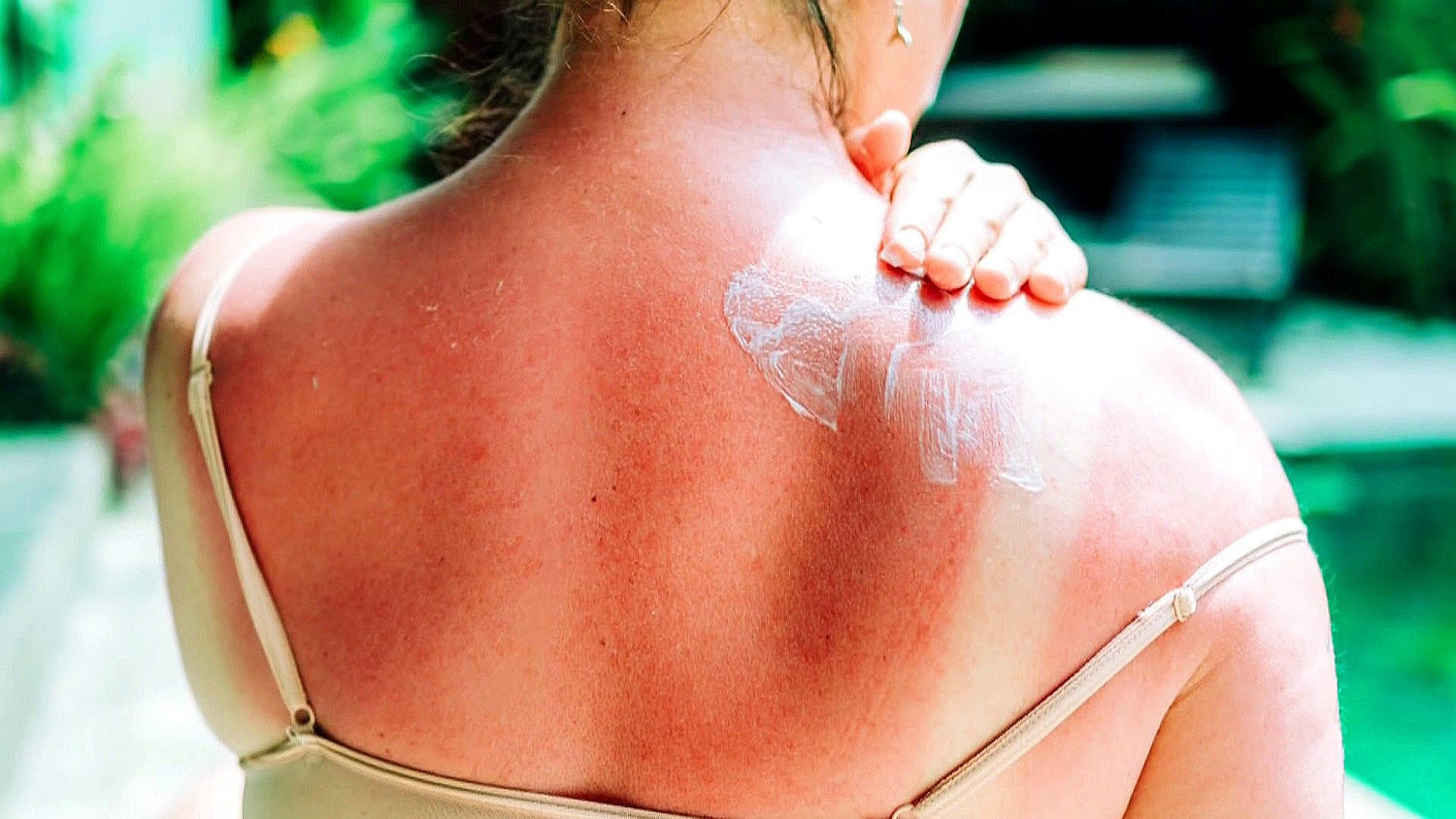 First New Sunscreen Type in 25 Years Hits US Store Shelves​First New Sunscreen Type in 25 Years Hits US Store Shelves 