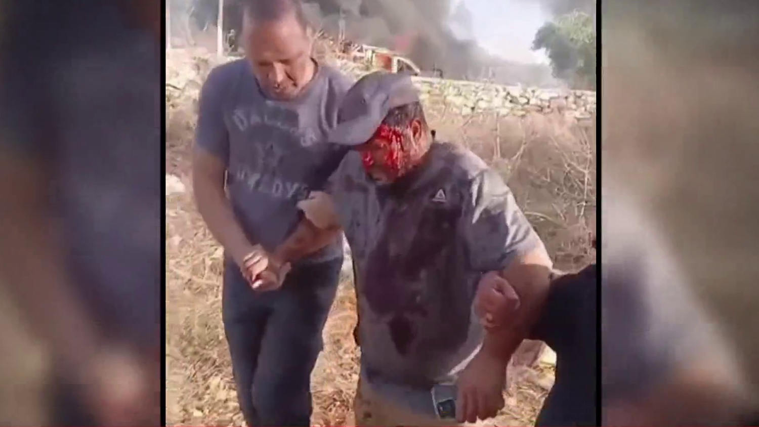 Israeli settlers attack American journalist in West Bank