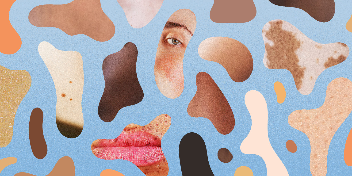 How to spot 18 common — and not so common — bumps, rashes and growths