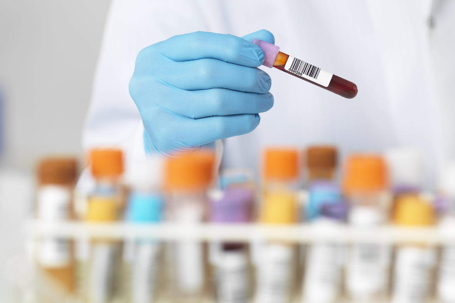 New cholesterol drug lowers LDL when statins aren’t enough, study finds