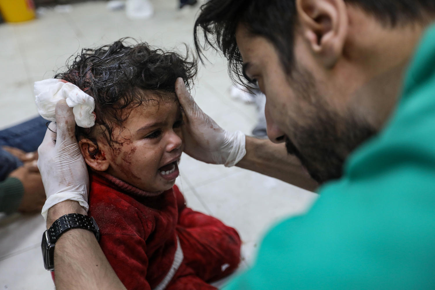 'Nowhere is safe': Doctors in Gaza describe the horror of caring for children affected by war