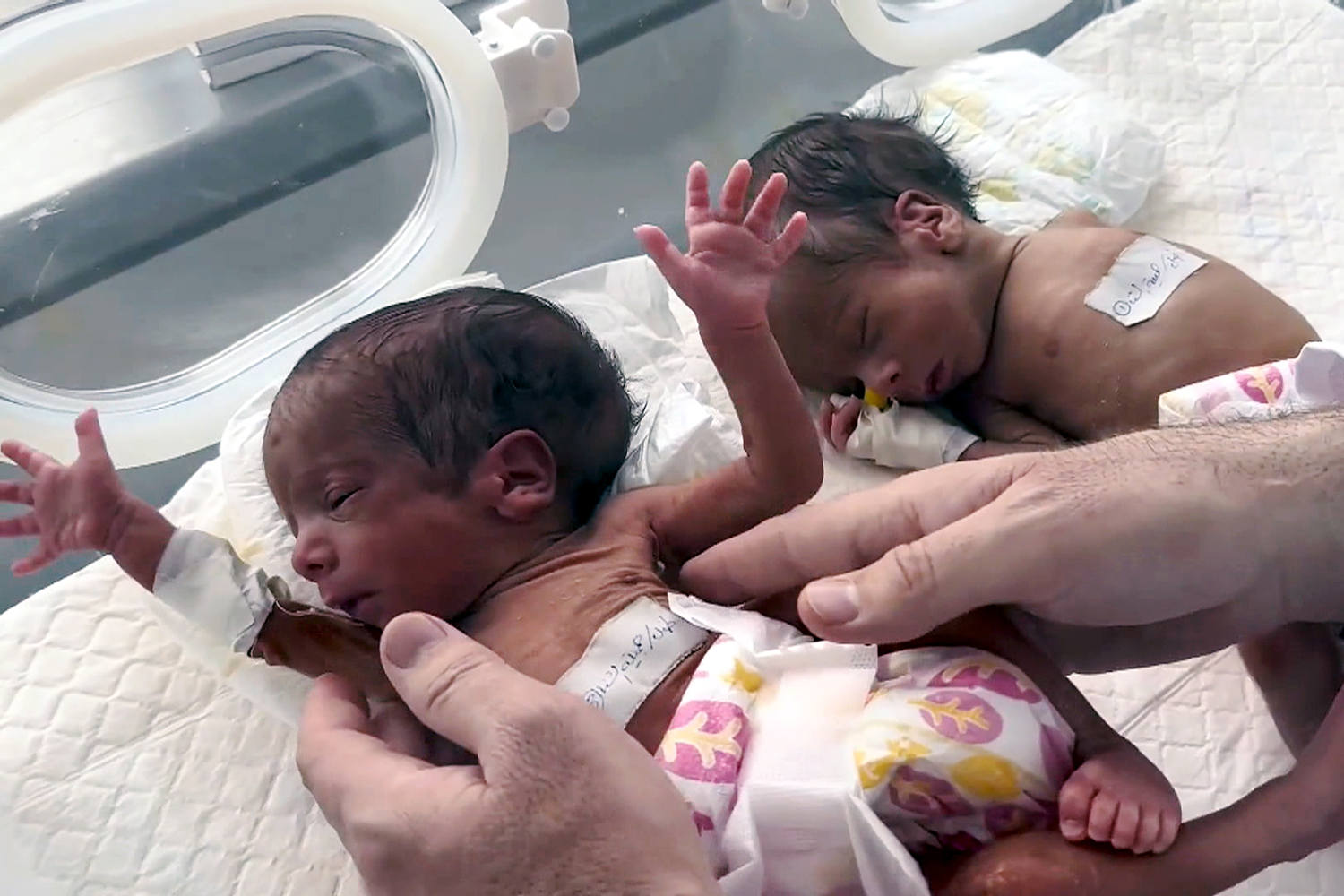 'I kept on saying goodbye': Gaza hospital reports rise in stillbirths and infant deaths