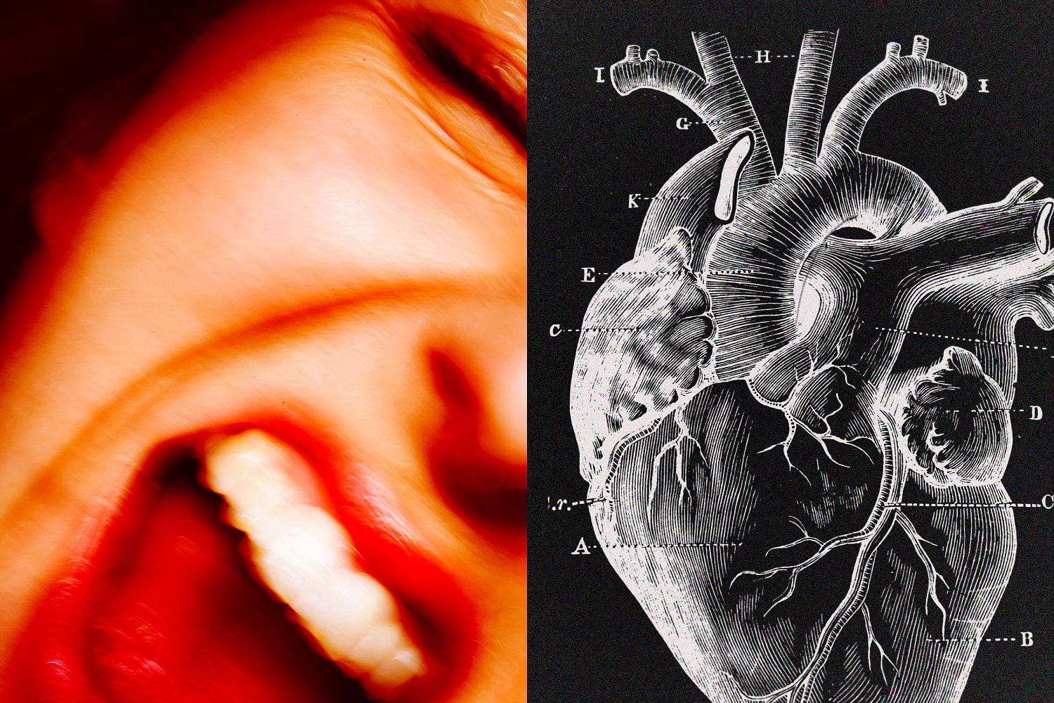 New research shows how a surge of anger could raise heart attack risk