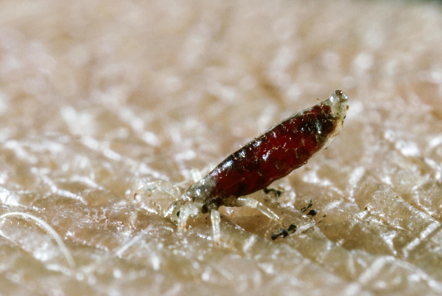 Blood-sucking body lice may have spread plague more than thought, science suggests