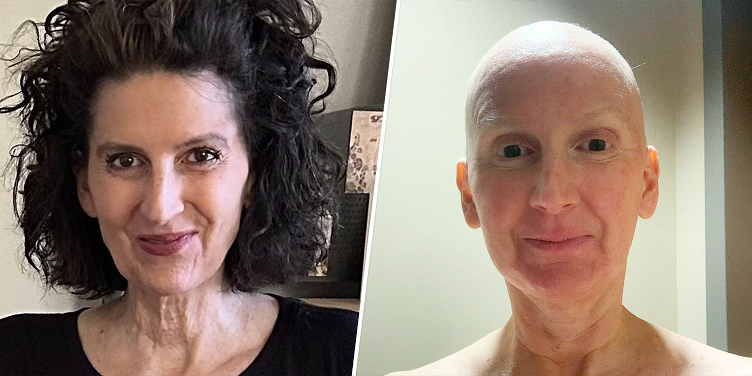 Woman shaken after leg pain turns out to be cancer, requires 'red devil' chemotherapy