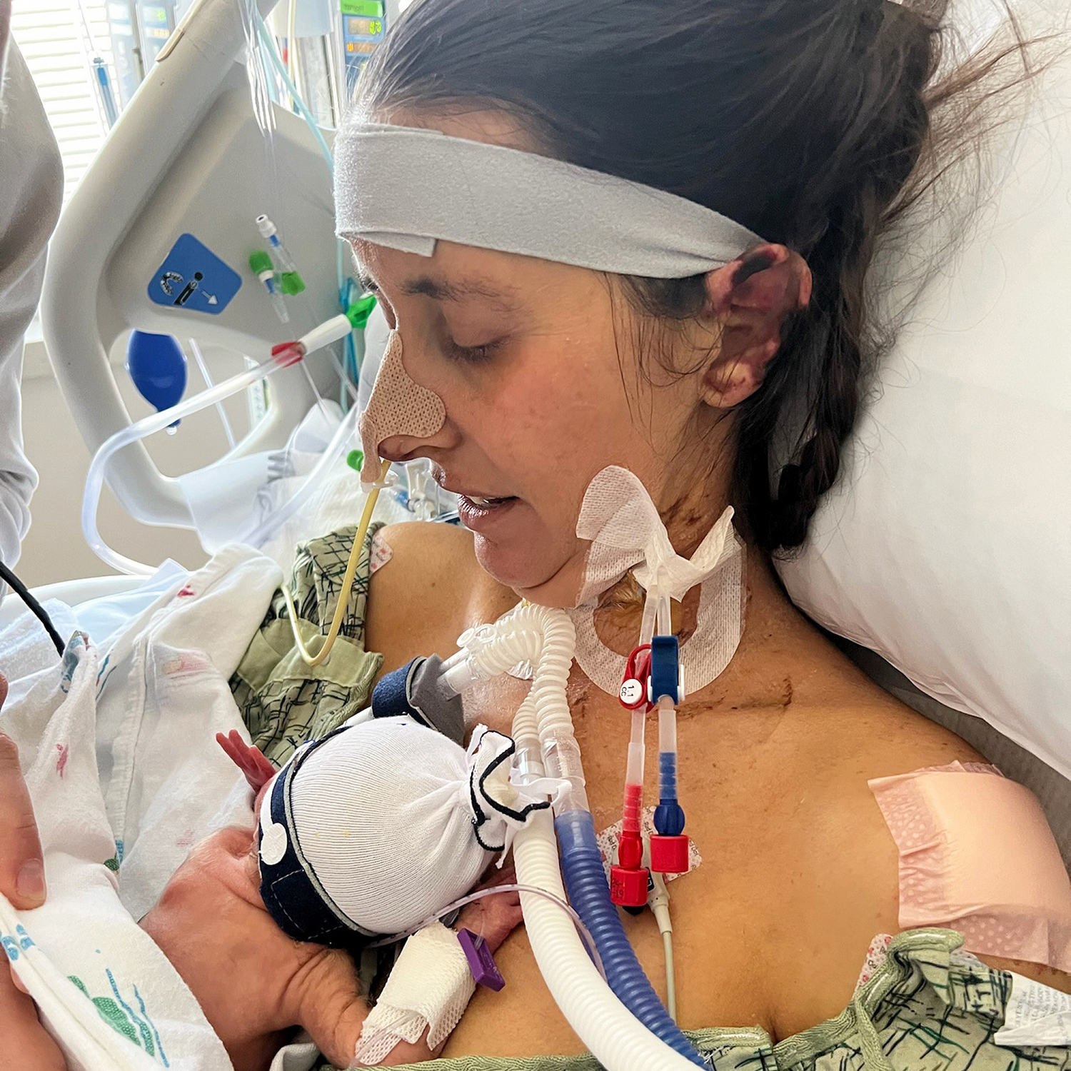 EXCLUSIVE: Pregnant mom, 35, has 4 limbs amputated due to strep infection. This was her 1st symptom