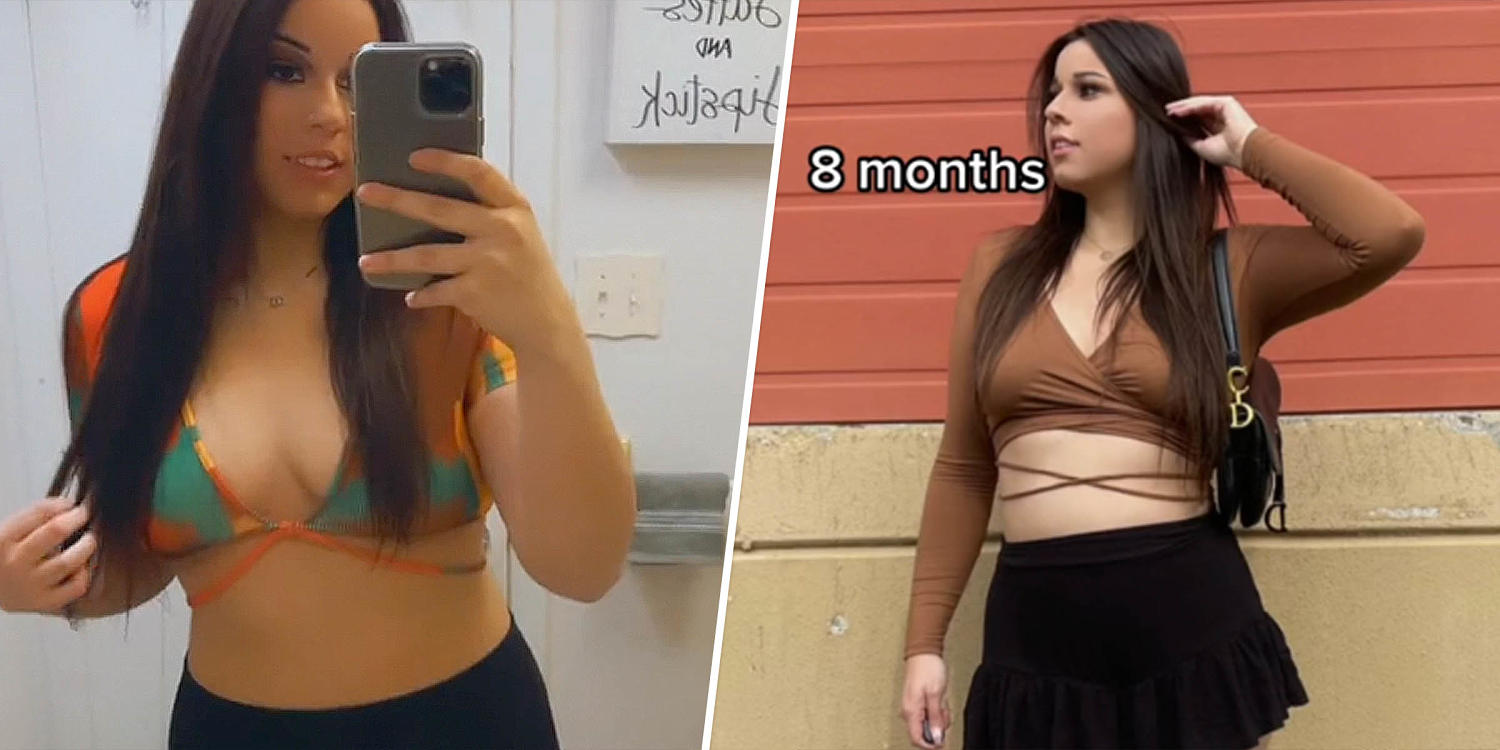 Mom never had a bump during her (healthy) pregnancy — doctors explain how it happens