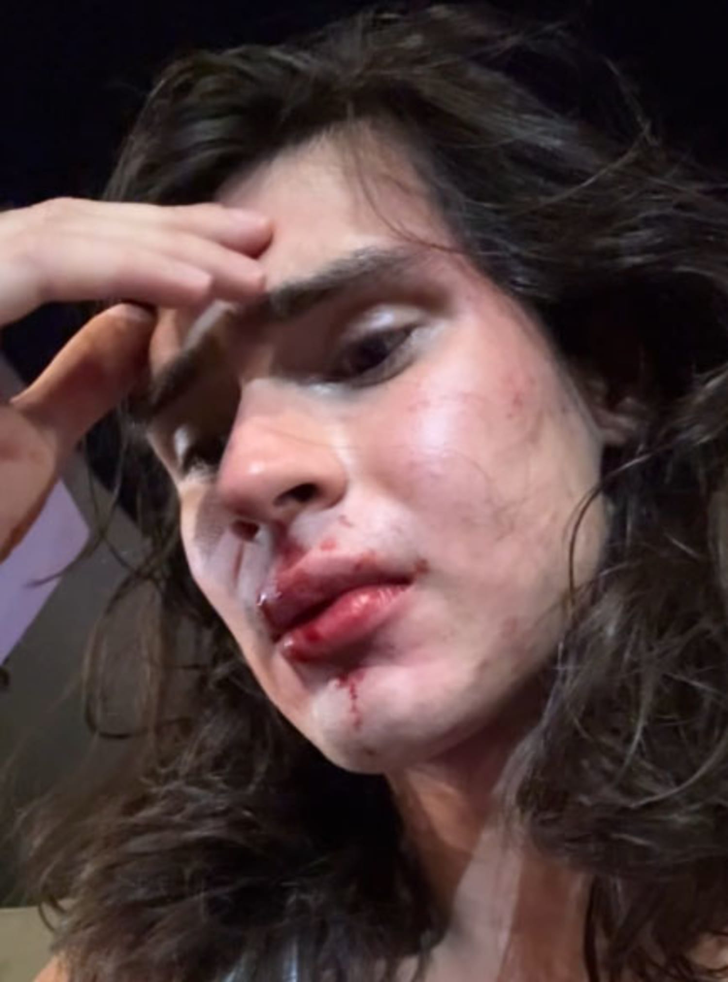 D.C. police investigate assault of gay model as a hate crime