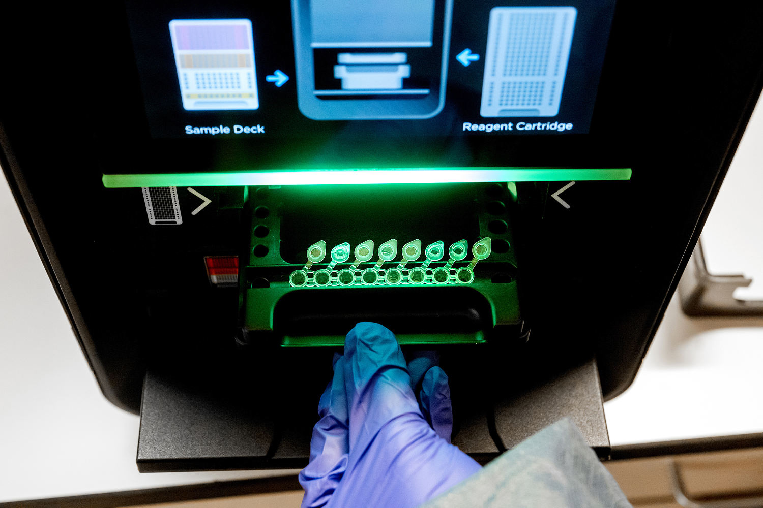 Cutting-edge test uses DNA sequencing to yield diagnoses for some medical mysteries