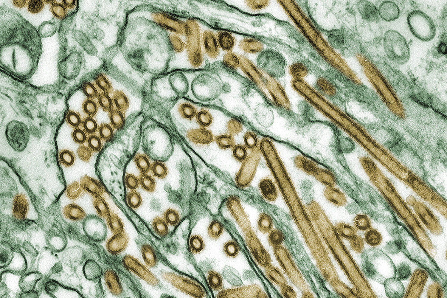 Bird flu samples show mutations that may make it easier to spread to people, CDC reports