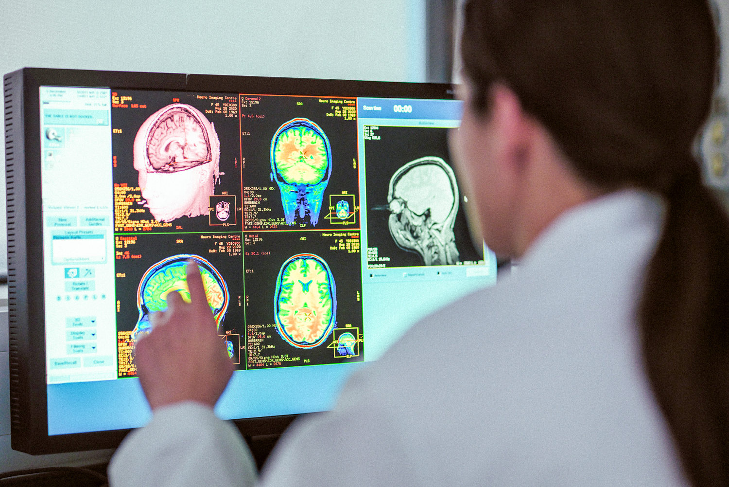 Mysterious brain diseases in Canada weren’t a mystery after all
