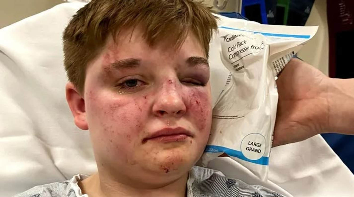 Lesbian teen brutally beaten at Illinois McDonald's