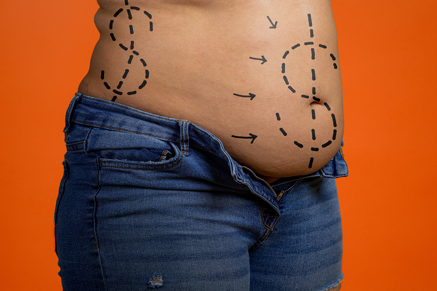 Patients say cosmetic surgery chains left them disfigured