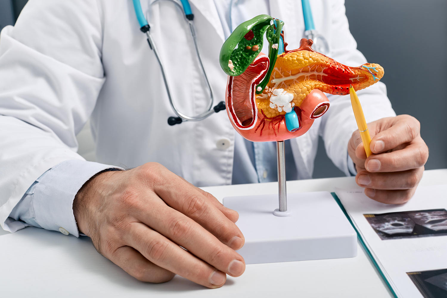 250808 pancreas anatomical model aa 457 06fefd
