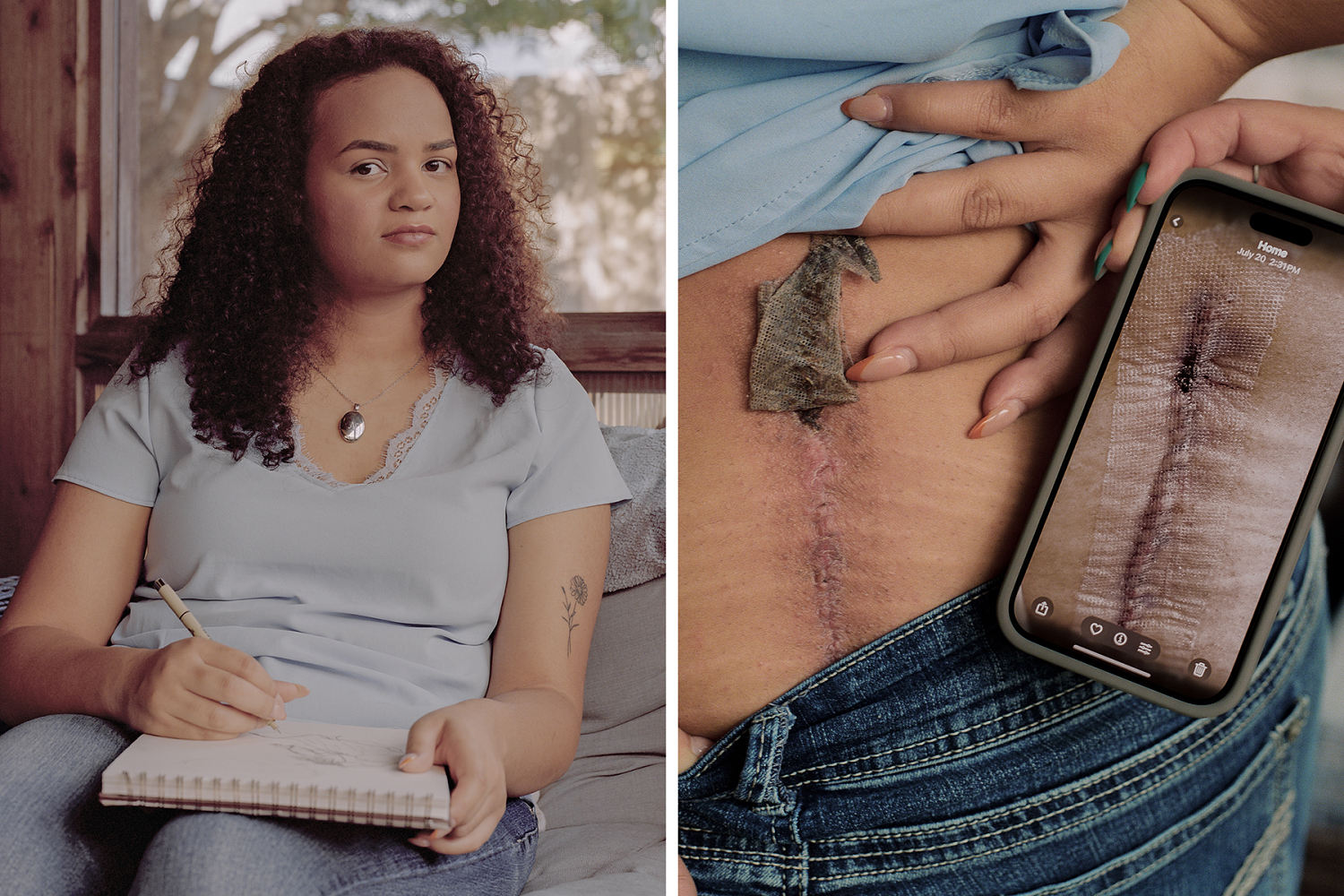 Her spine surgery was denied. Doctors say it's all too common.