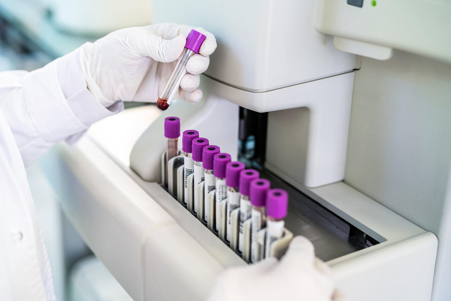 Why some women at risk of heart attack and stroke go undetected and undertreated