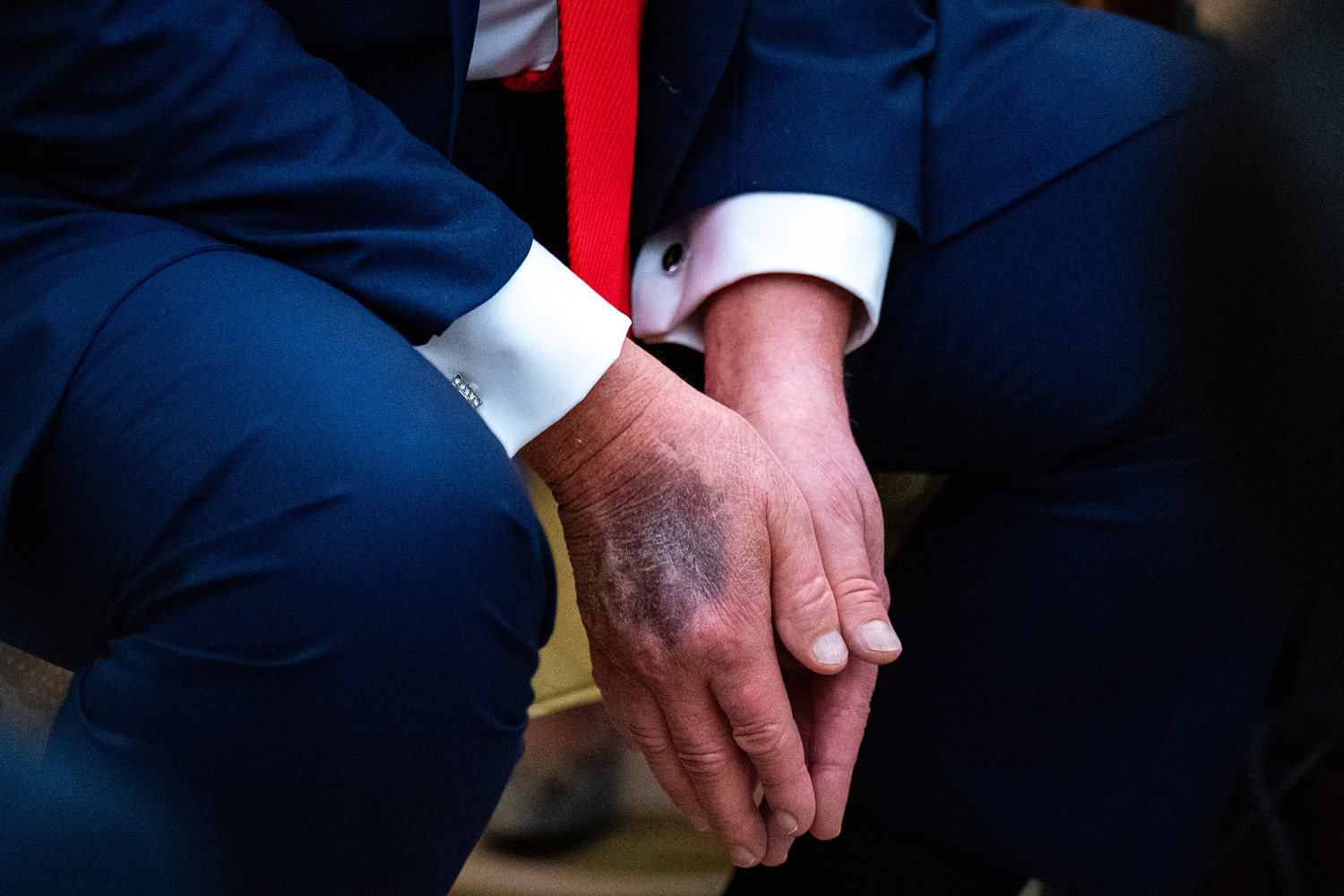 Trump, who questioned his opponents' health, rebuffs rumors about his own