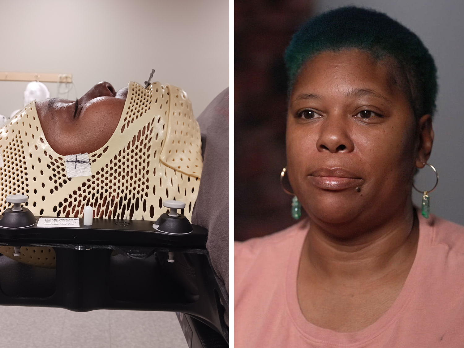 Is Depo-Provera birth control to blame for this woman’s brain tumor?