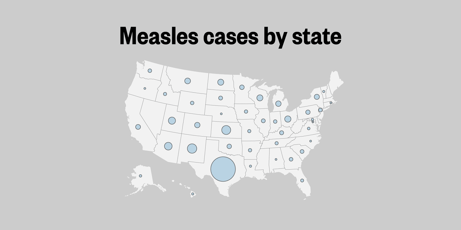 Map: Track the spread of measles in the U.S.​Map: Track the spread of measles in the U.S. 