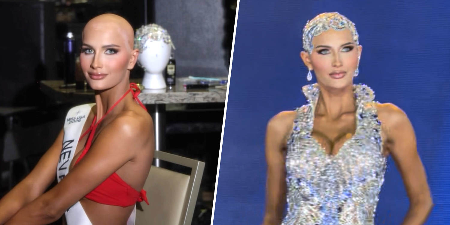 Miss USA Contestant Is First With Total Hair Loss from Alopecia: 'I'm Still Me'