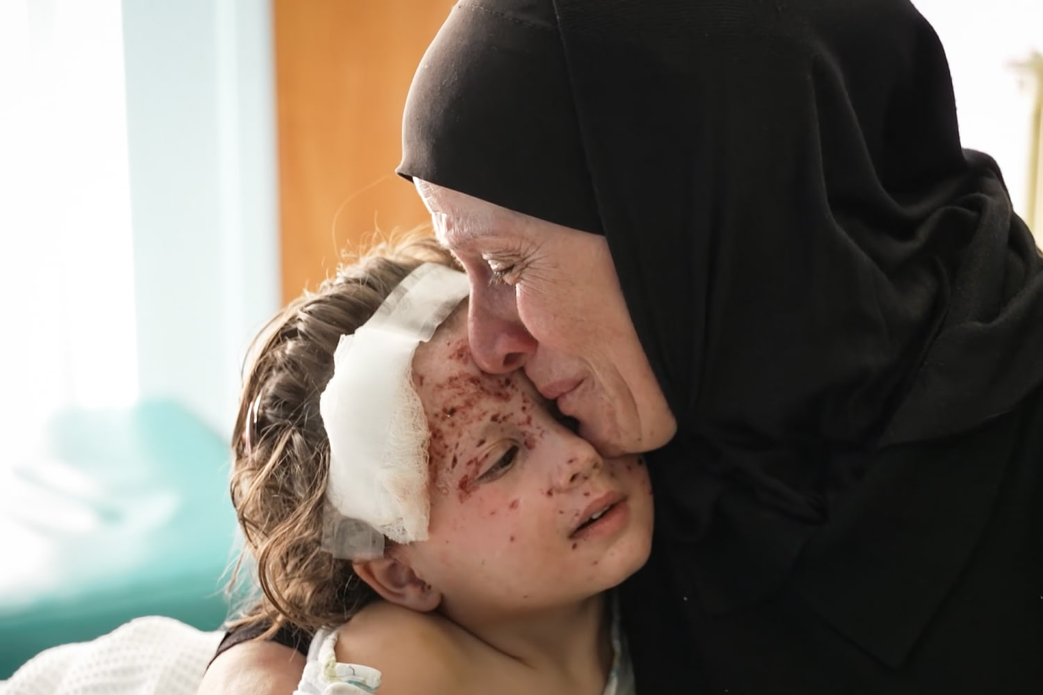 For a surgeon treating Lebanon’s wounded children, their horrific injuries bring back memories from Gaza