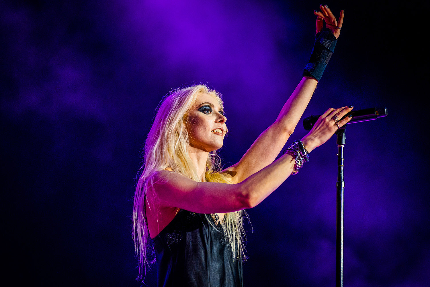 Taylor Momsen hospitalized with spider bite, posts photo of bite spreading up her leg