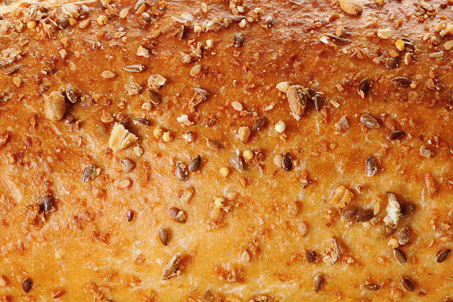 Stop scrolling and eat lentils: New guidelines to prevent hemorrhoids