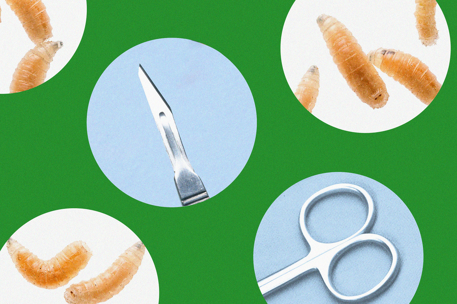 Got maggots? These doctors are bringing the bugs into their practice on purpose