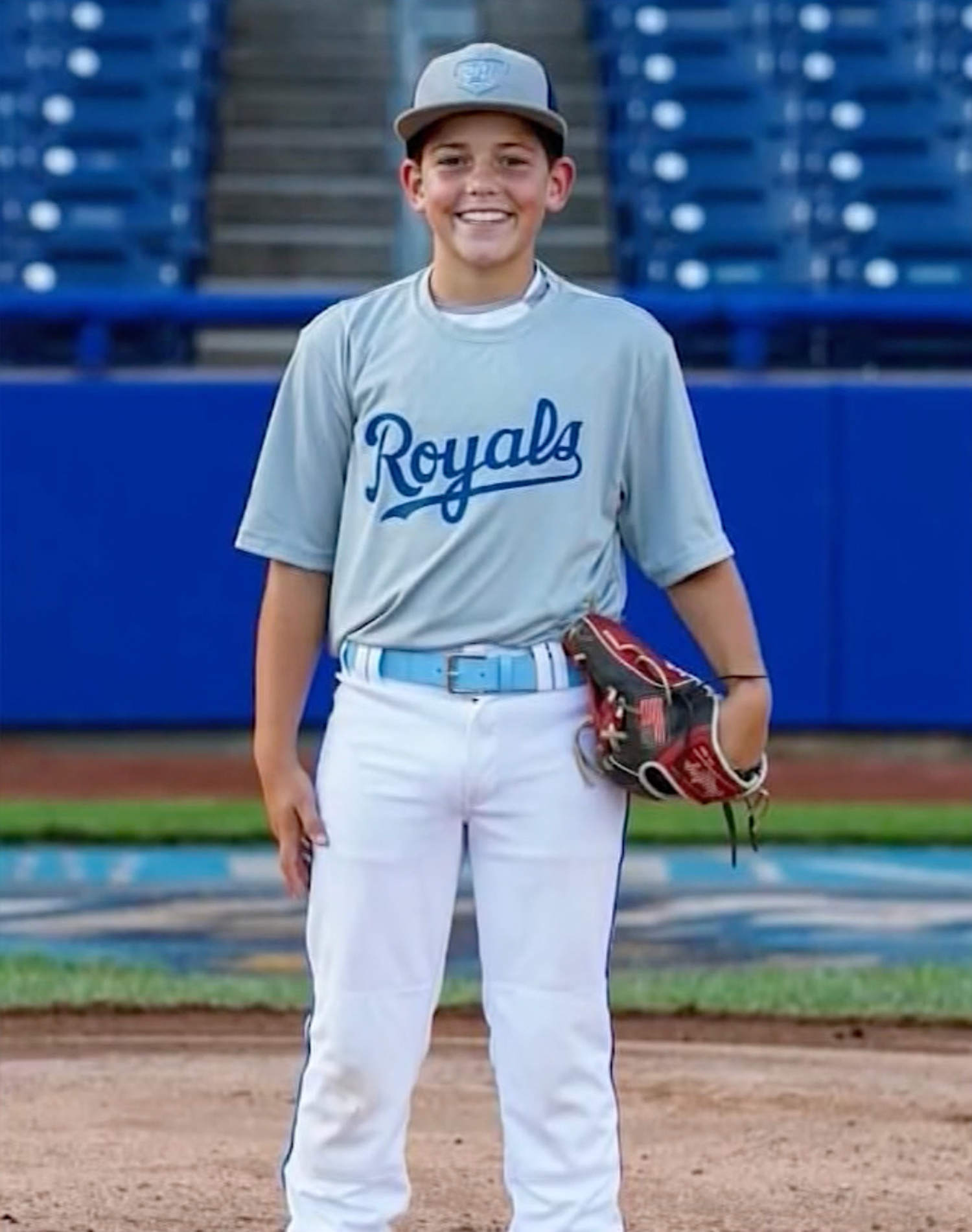 12-year-old boy in critical condition after baseball strikes head during warmups