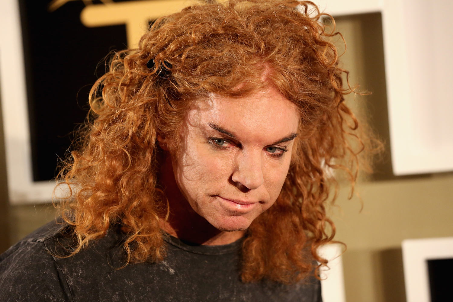Comedian Carrot Top hospitalized and recovering, representative says