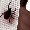 Important tips to protect you from ticks and the diseases they carry