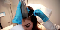 What is PRP and how does it treat thinning hair and hair loss?